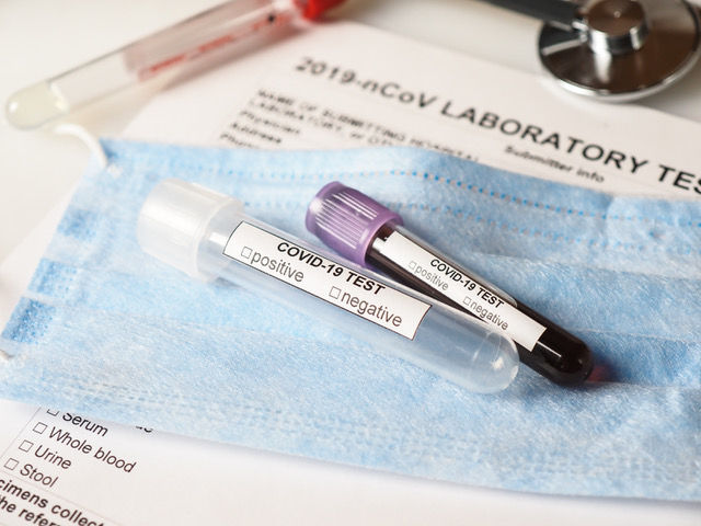 Coronavirus COVID-2019 test concept